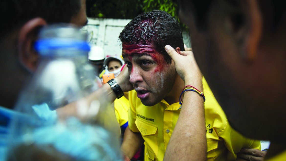 El diputado de la Asamblea Nacional José Manuel Olivadres recibe atención luego de resultar herido en un enfrentamiento. 