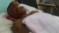 Leonardo Rodríguez, uno de los heridos en la explosión de la fábrica de lácteos en Bayamo. Leonardo Rodríguez, uno de los heridos en la explosión de la fábrica de lácteos en Bayamo.