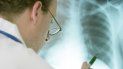 Un médico valora la radiología de un paciente con una enfermedad pulmonar. Un médico valora la radiología de un paciente con una enfermedad pulmonar.
