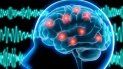 La epilepsia es una enfermedad del sistema nervioso. La epilepsia es una enfermedad del sistema nervioso.