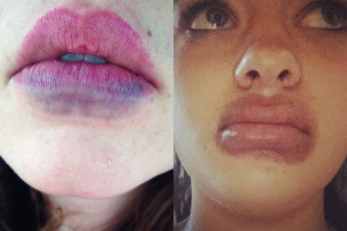 El Reto Para Obtener Labios Como Kylie Jenner Es El Nuevo Furor En Las
