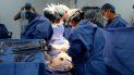 Fotografía fechada el 11 de abril de 2019 y cedida por la Fundación Cardiovascular de Colombia que muestra a un grupo de cirujanos mientras realizan una cirugía de corazón a la niña Carol Mariana Acosta. Fotografía fechada el 11 de abril de 2019 y cedida por la Fundación Cardiovascular de Colombia que muestra a un grupo de cirujanos mientras realizan una cirugía de corazón a la niña Carol Mariana Acosta.