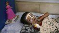 Una niña desnutrida permanece en una cama en una unidad del hospital Indira Gandhi en Kabul, Afganistán Una niña desnutrida permanece en una cama en una unidad del hospital Indira Gandhi en Kabul, Afganistán