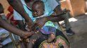 En esta foto del 11 de diciembre del 2019, funcionarios de salud vacunan a residentes de la aldea de Tomali, en Malawi. Un bebé tras otro en Malawi está recibiendo la primera y única vacuna contra la malaria, una de las enfermedades más mortíferas y persistentes en el mundo. En esta foto del 11 de diciembre del 2019, funcionarios de salud vacunan a residentes de la aldea de Tomali, en Malawi. Un bebé tras otro en Malawi está recibiendo la primera y única vacuna contra la malaria, una de las enfermedades más mortíferas y persistentes en el mundo.