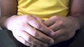 Esta imagen tomada de un video muestra las manos de un brasileño que estaba infectado con el virus del SIDA y no ha mostrado ningún indicio del mismo por más de un año después de haber dejado de tomar medicamentos para el VIH luego de una terapia intensa con una droga experimental dirigida a eliminar virus oculto en su cuerpo, dijeron médicos el martes, 7 de julio del 2020. Esta imagen tomada de un video muestra las manos de un brasileño que estaba infectado con el virus del SIDA y no ha mostrado ningún indicio del mismo por más de un año después de haber dejado de tomar medicamentos para el VIH luego de una terapia intensa con una droga experimental dirigida a eliminar virus oculto en su cuerpo, dijeron médicos el martes, 7 de julio del 2020.