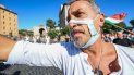 Un hombre con una mascarilla recortada participa en una protesta de los movimientos No Mask, movimientos negacionistas del COVID-19 movimientos anti-5G y movimientos anti-vacunación contra la política de salud del gobierno el 5 de septiembre de 2020 en Roma durante el COVID-19. Infección, causada por el nuevo coronavirus. Un hombre con una mascarilla recortada participa en una protesta de los movimientos No Mask, movimientos negacionistas del COVID-19 movimientos anti-5G y movimientos anti-vacunación contra la política de salud del gobierno el 5 de septiembre de 2020 en Roma durante el COVID-19. Infección, causada por el nuevo coronavirus.