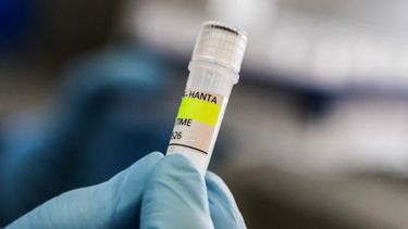 Argentina ha registrado un aumento en los casos de hantavirus, pero no un brote, según declaró un experto a la AFP el 6 de mayo, mientras que las infecciones a bordo de un crucero han provocado una alarma sanitaria mundial. El MV Hondius zarpó de Ushuaia, en el sur de Argentina, el 1 de abril y actualmente se encuentra anclado frente a las costas de Cabo Verde tras la muerte de tres pasajeros, posiblemente a causa del hantavirus.