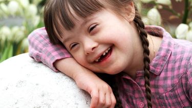 Destacado Según la Sociedad Nacional del Síndrome de Down, en EEUU hay más de 400.000 personas con este trastorno. (Archivo)