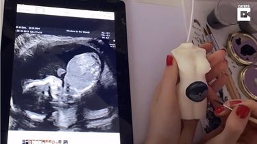Adolescente pinta ecografías de bebés en velas&nbsp;