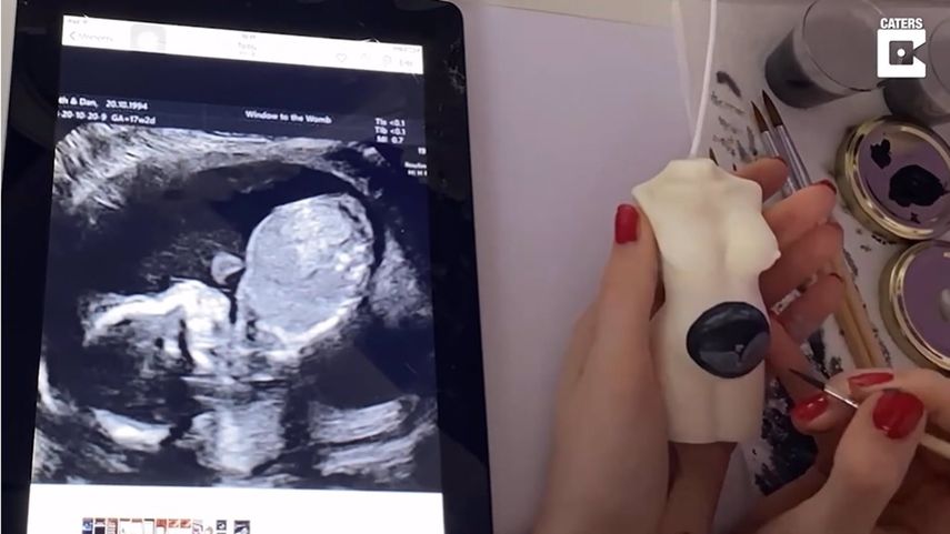 Adolescente pinta ecografías de bebés en velas&nbsp;