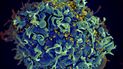 Esta imagen captada con un microscopio electrónico y facilitada por los Institutos Nacionales de Salud de Estados Unidos muestra una célula T, en azul, siendo atacada por el VIH, el virus que causa el sida, en amarillo. 