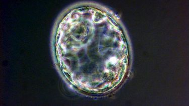 Blastocito de cinco días de un embrión&nbsp;humano&nbsp;clonado