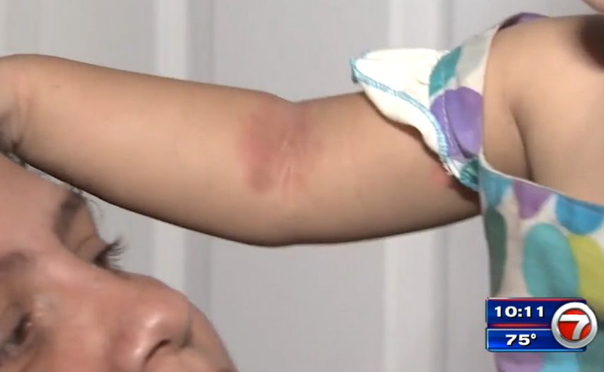 Una madre mostró el estado en que ha quedado su hija después de que habría sido atacada por roedores en La Pequeña Habana.