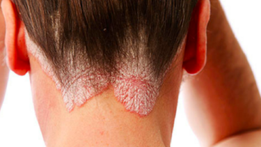 Diario las Américas | Screen Shot 2017-08-04 at 10.51.00 AM.png