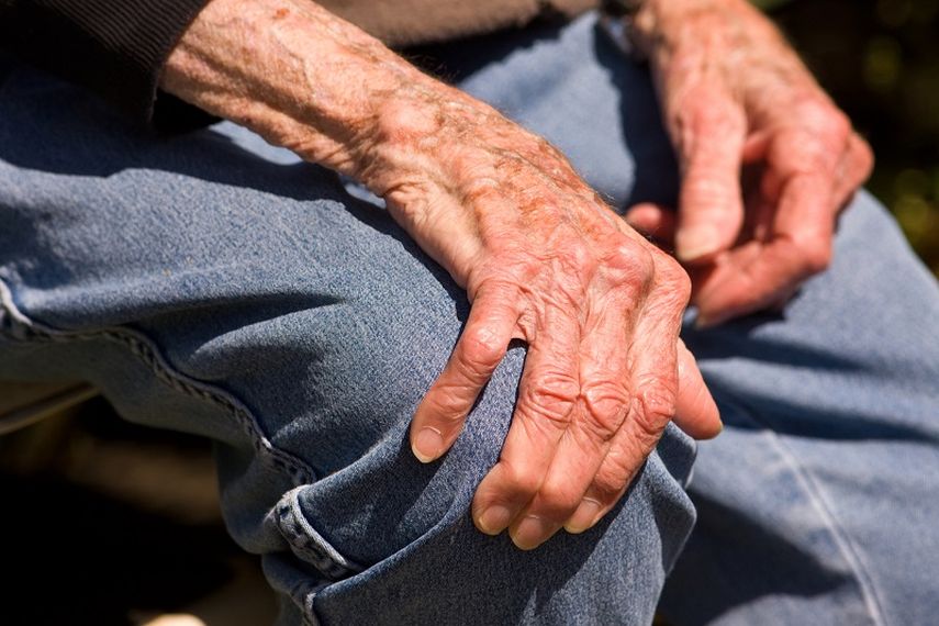 El mal de Parkinson representa el segundo trastorno neurodegenerativo por su frecuencia, situándose detrás del Alzheimer. (Archivo)