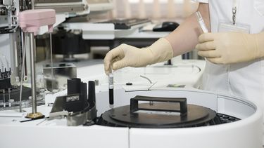 Según cifras del Instituto Nacional de Cáncer de Estados Unidos, los tipos de cáncer que registran más personas fallecidas en Latinoamérica y el Caribe son el de pulmón, con 74.602, seguidos por las 43.200 muertes del de mama y en la tercera posición el cáncer de hígado, causante de unas 31.200.