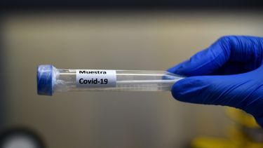 Una muestra de Covid-19
