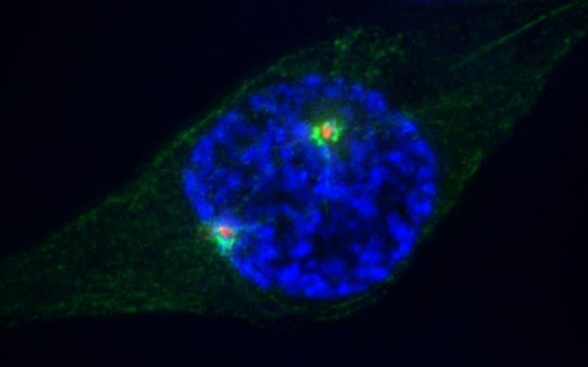 Imagen microscópica de una célula humana durante su división.