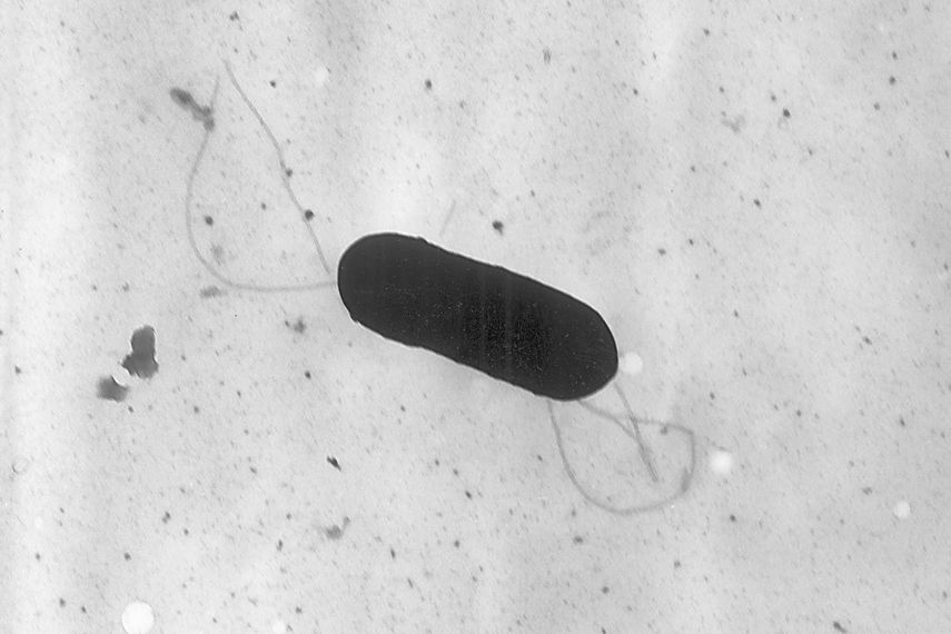 Imagen de microscopio electrónico facilitada por los Centros para el Control y la Prevención de Enfermedades de Estados Unidos (CDC por sus siglas en inglés) muestra una bacteria Listeria monocytogenes que causa la listeriosis.