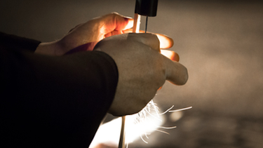 Cómo tratar una quemadura