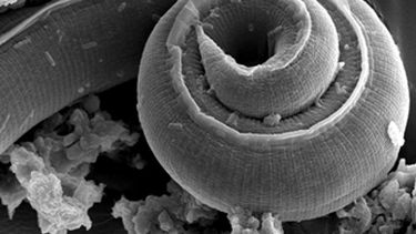 El parásito angiostrongylus cantonensis ya es un problema de salud pública en Hawai y diversas partes de Asia,(Archivo)