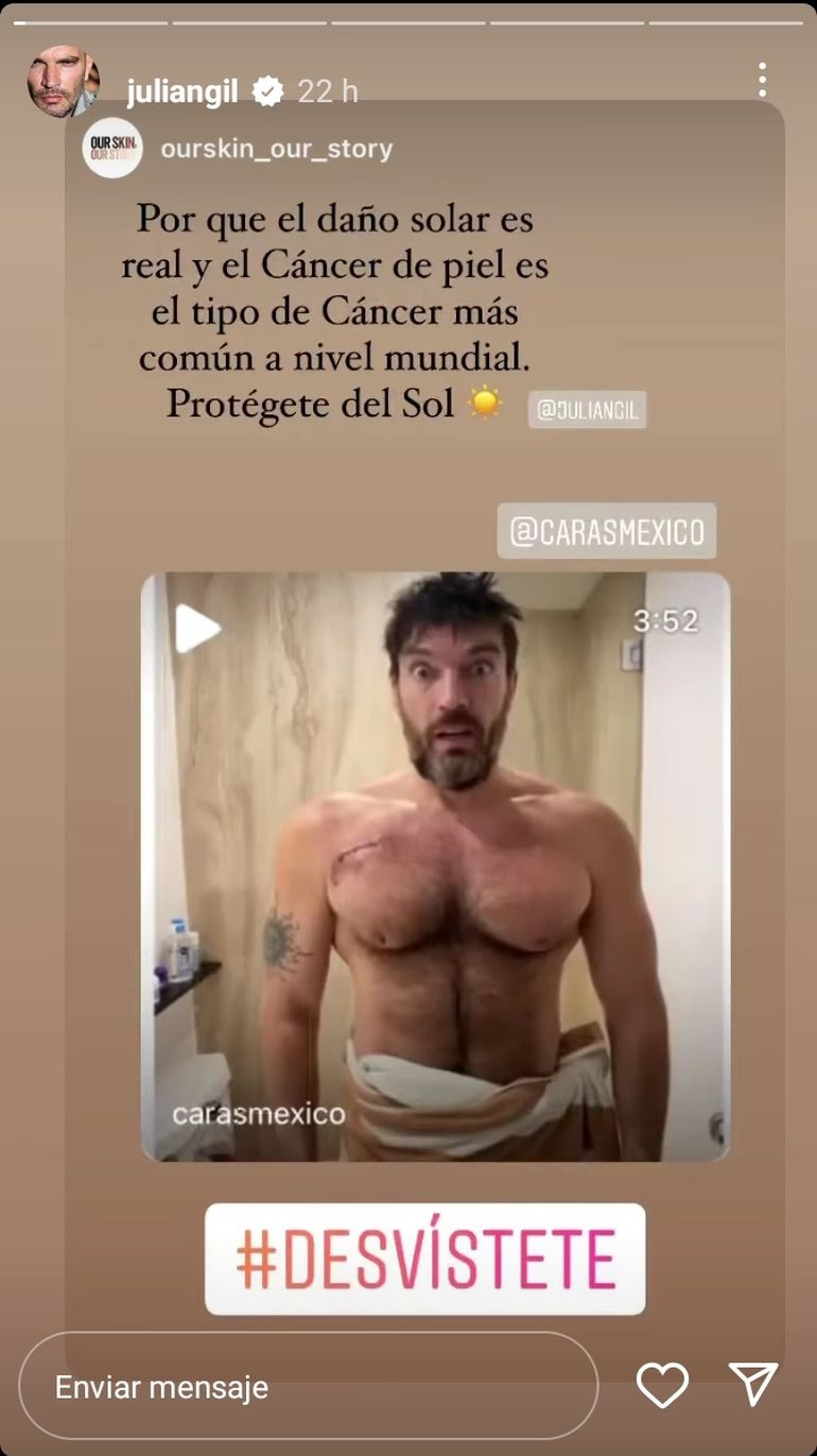 Julián Gil revela que padeció cáncer de piel