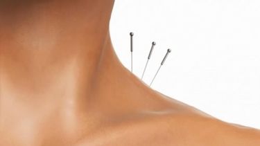 Para muchos las agujas son una solución.(Archivo)