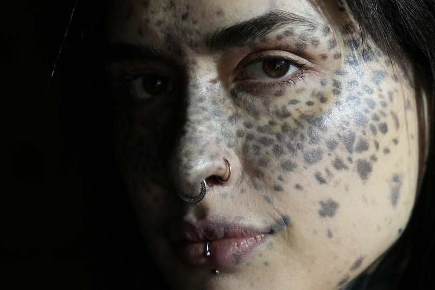 Sonia Sparta posa durante una sesión fotográfica de la agencia de modelos Limperfetta (La imperfecta) en Roma. Sonia tiene hiperpigmentación en la piel.&nbsp;