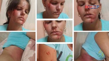 Encapuchados propinan golpiza a periodista independiente en Cuba