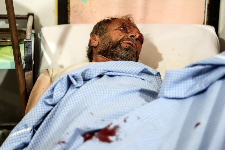 Un hombre víctima de una bomba recibe atención médica en Douma (Siria) hoy, según fuentes, las fuerzas leales al régimen de Al Assad lanzaron bombas aéreas a Douma y otras ciudades de la localidad de Ghouta. No hay cifra oficial de heridos o fallecidos