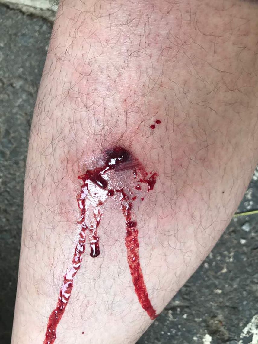 Herida en la pierna del diputado Carlos Paparoni.