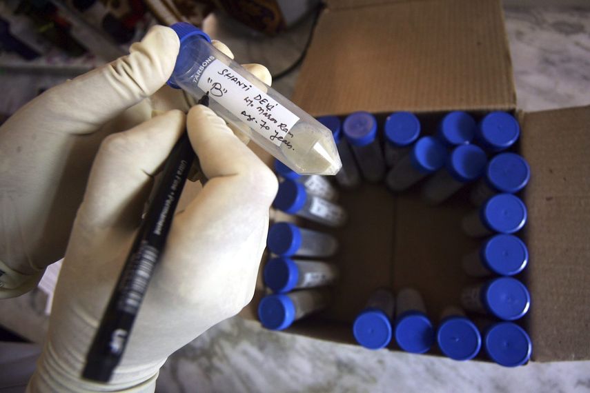 Su estudio ha observado que las bacterias responsables de la tuberculosis generan moléculas que les resultan tóxicas cuando el entorno es desfavorable.