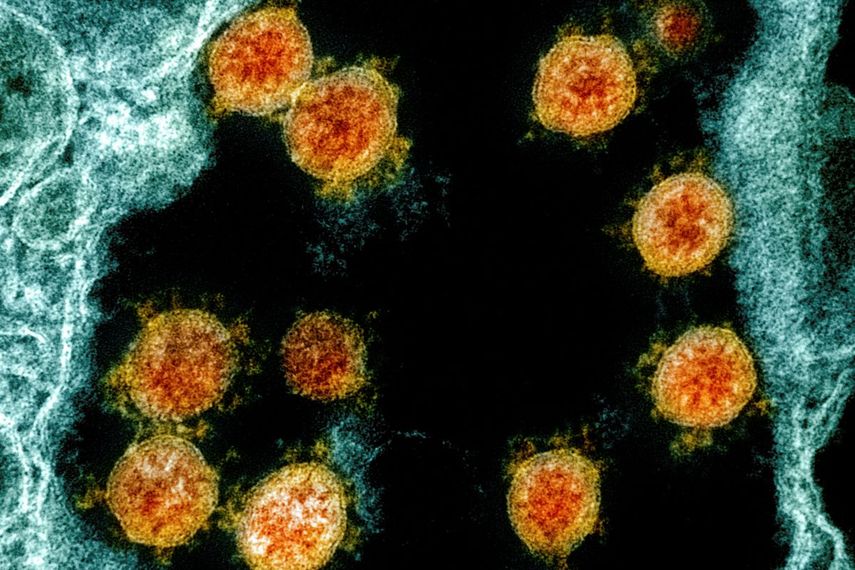 Esta imagen tomada con un microscopio electr&oacute;nico y prove&iacute;da y mejorada por el Instituto Nacional de Alergia y Enfermedades Infecciosas de Estados Unidos en Fort Detrick, Maryland, en el 2020, muestra part&iacute;culas del Coronavirus SARS-CoV-2 aisladas de un paciente.&nbsp;