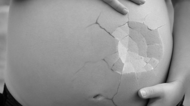 Imagen que ilustra la interrupción de un embarazo.