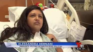 Alessandra Hernani se encuentra hospitalizada en el Jackson Memorial.