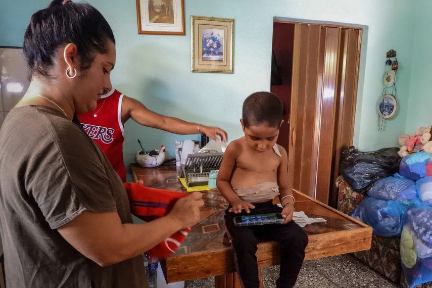 Jessica Rodríguez Romero viste a su hijo, Luis Angelo, después de completar una sesión de alimentación necesaria debido a su traqueotomía, en su casa en el barrio de Santa Fe de La Habana, el 2 de julio de 2025.