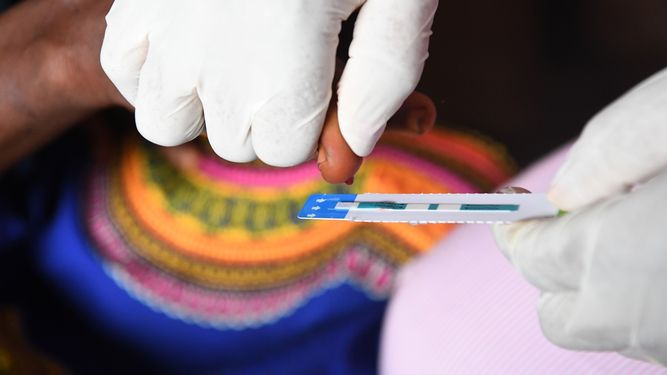 12 millones de pacientes de VIH no reciben tratamiento según OMS