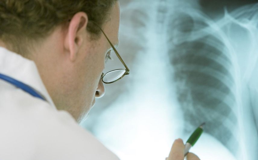 Un médico valora la radiología de un paciente con una enfermedad pulmonar.