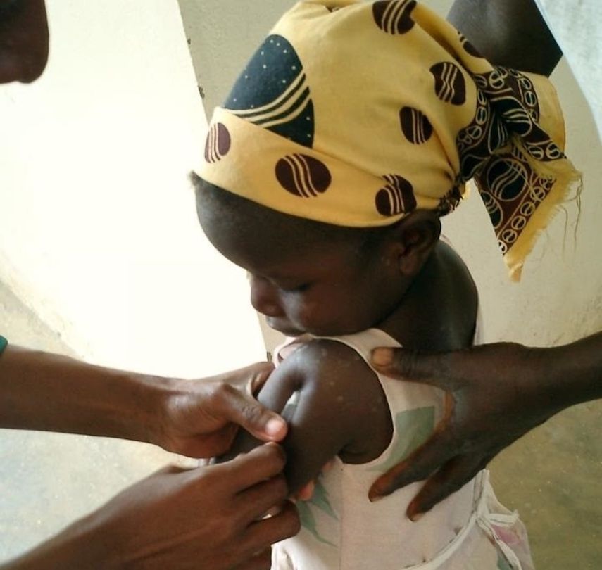 Una niña en un centro de salud de Mozambique recibe una inyección de la vacuna contra la malaria. &nbsp; &nbsp;
