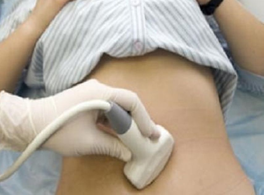 La investigación permitió identificar las células que contribuyen al desarrollo del tumor ovárico.(Archivo)