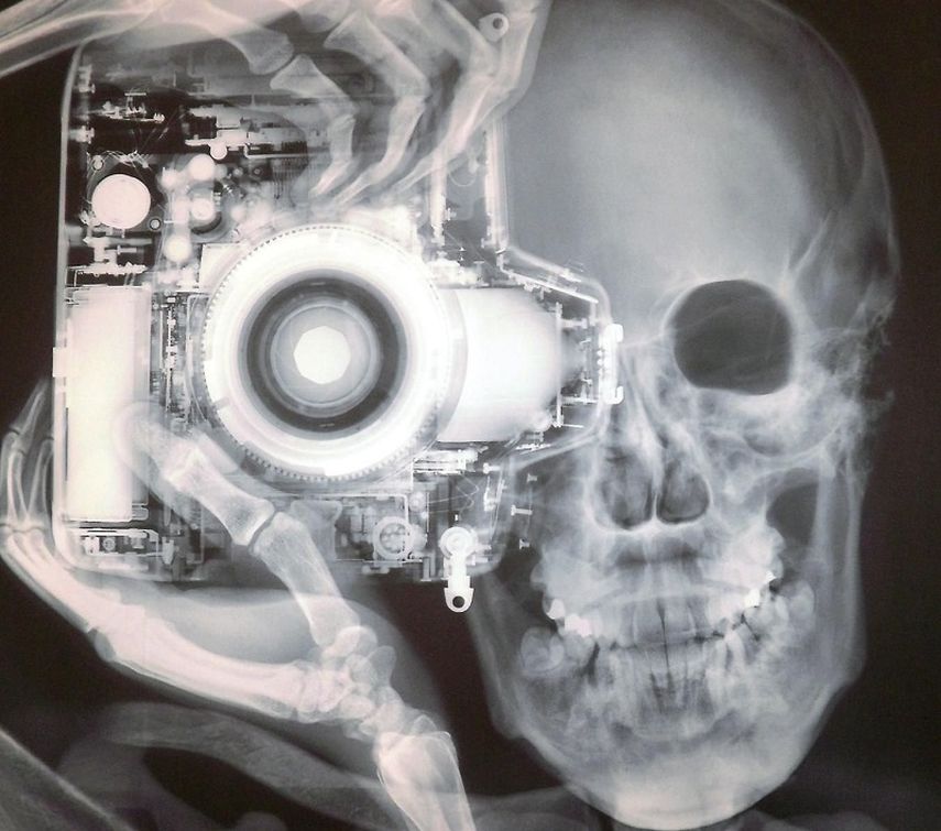 Sólo unos pocos descubrimientos han influenciado tanto la medicina, la tecnología y la ciencia como los rayos X. (Archivo)