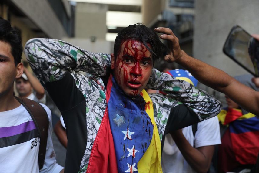 Un manifestante herido durante enfrentamientos con la Policía Nacional Bolivariana participa durante una protesta contra el usurpador de Venezuela, Nicolás Maduro, este miércoles en Caracas