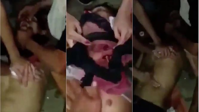 Un video captó el estado en el que quedó un estudiante tras ser atacado brutalmente por las fuerzas policiales.