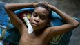 Ángel Céspedes, de 14 años, en una cama sintiéndose mal después de un tratamiento de diálisis en su casa en Valles del Tuy en las afueras de Caracas, Venezuela, el lunes 8 de noviembre de 2021. Tanto Ángel como su madre han estado en diálisis durante años y necesitan trasplantes de riñón.&nbsp;