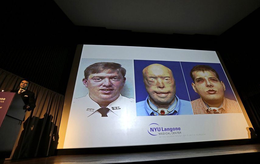 Hardison sufrió quemaduras de tercer grado hace catorce años cuando trabajaba como bombero voluntario y al entrar en una casa en llamas en busca de una mujer, el techo se derrumbó sobre él. (EFE)