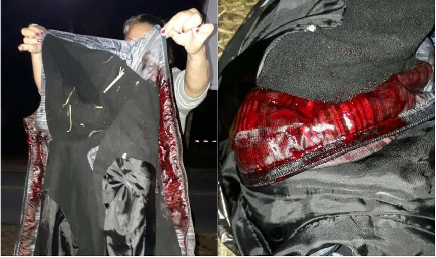 Una manifestante muestra una prenda de ropa manchada de sangre tras el ataque en el campamento de Curitiba.&nbsp;