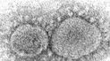 En esta imagen de microscopio de 2020 difundida por los Centros para el Control y la Prevención de Enfermedades se ven partículas del virus SARS-CoV-2, que causa el COVID-19.
