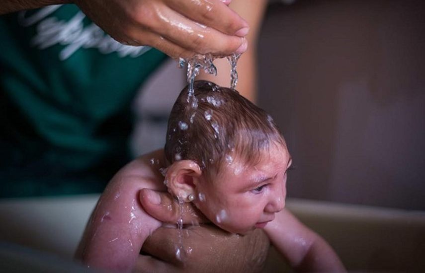 Los niños con microcefalia no alcanzan a tener un tamaño normal de su cerebro. (CORTESÍA. laprensa.hn)