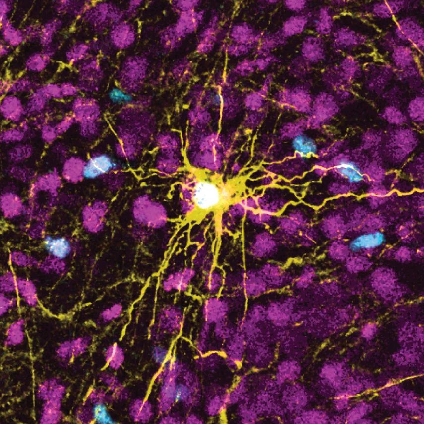Esta imagen microscópica provista por Pasca Lab/Stanford Medicine muestra un astrocito humano, centro amarillo, y células gliales humanas (azul) dentro del cerebro de una rata.