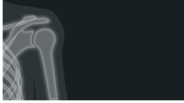 Los rayos X cumplen 126 años&nbsp;